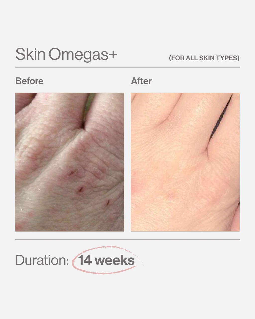 Skin Omegas+ - 4